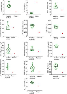 Case report: Complex evaluation of coagulation, fibrinolysis and inflammatory cytokines in a SARS-CoV-2 infected pregnant woman with fetal loss